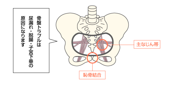 骨盤底のトラブル詳細図